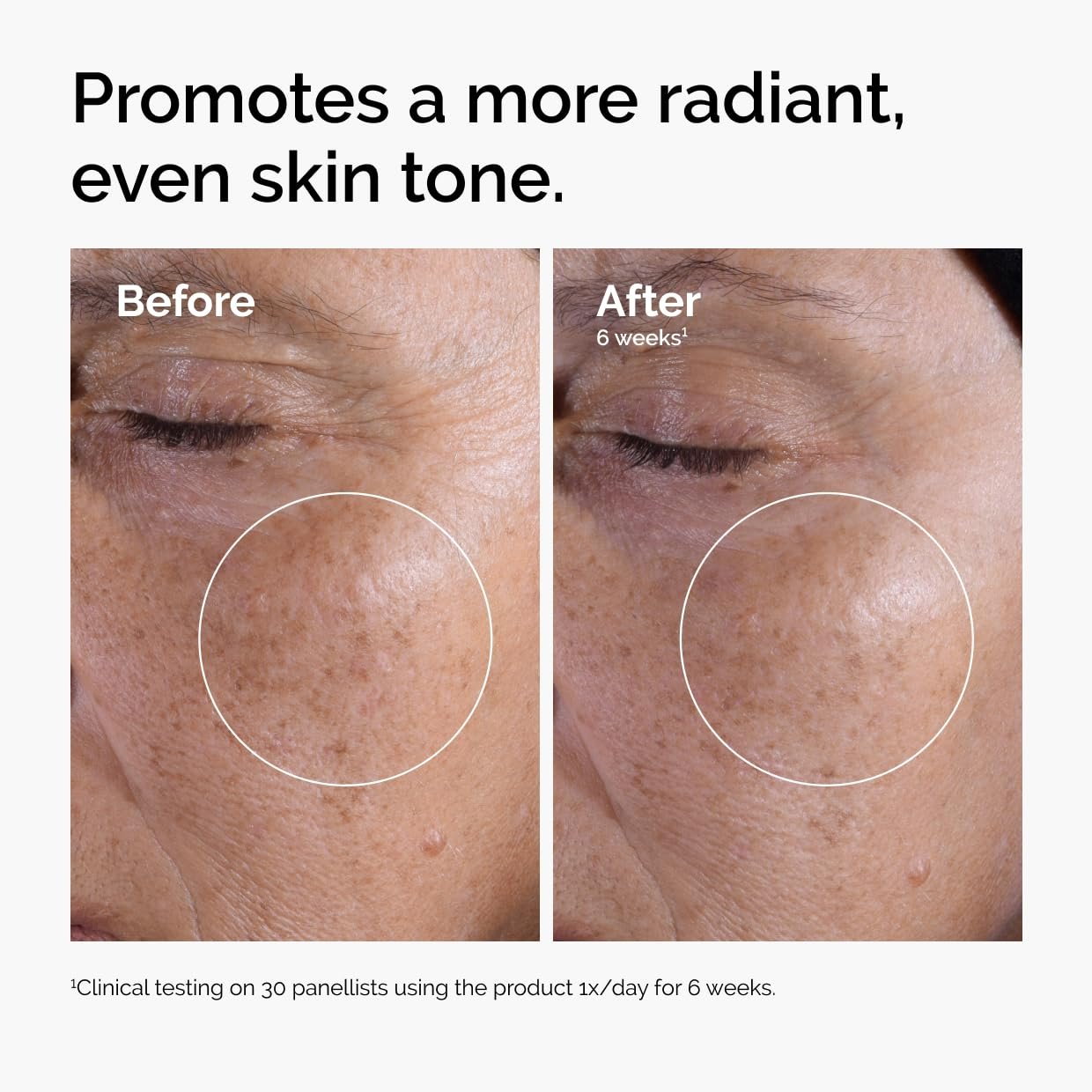 71kxp4jbszl. sl1240 The Ordinary Glycolic Acid 7% Exfoliating Toner, Brightening and Smoothing Daily Toner for More Even-Looking Skin Tone, 100ml